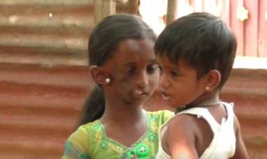 முக்கசிதைவுக்கு அறுவை சிகிச்சை செய்துகொண்ட ஆவடி சிறுமி டானியா இன்று டிஸ்சார்ஜ் ஆகிறார்