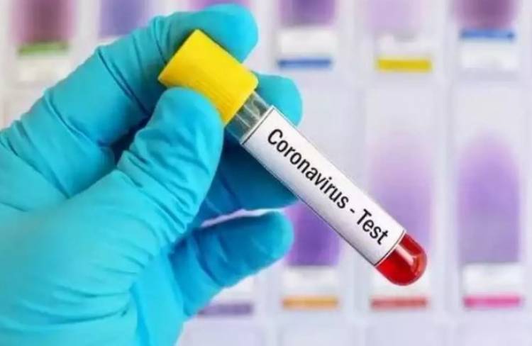 Global coronavirus count exceeds 5.3million toll over 342000