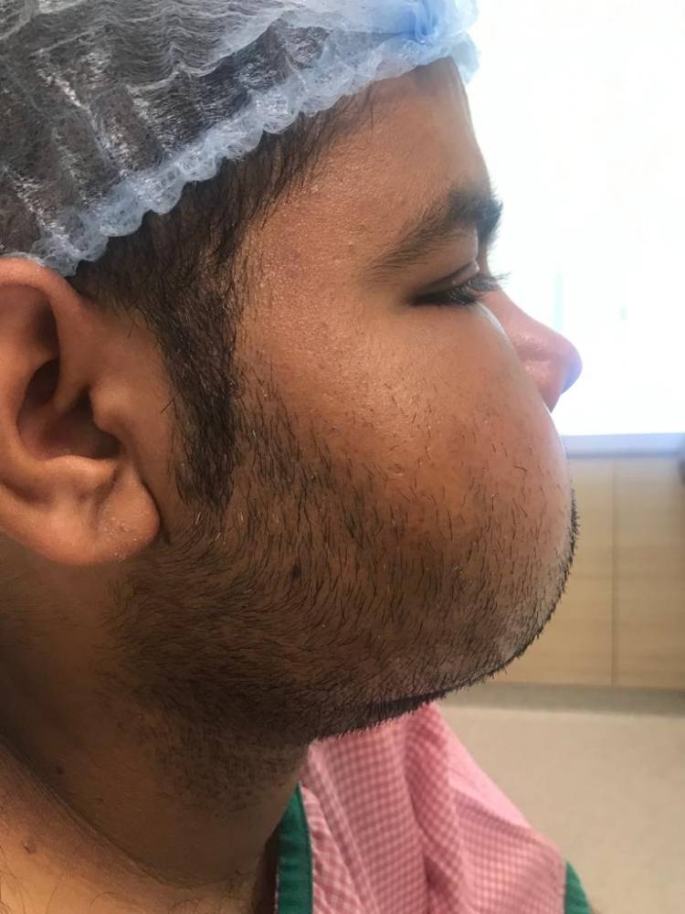 Successful scarless ENT surgery of rare massive jaw tumour at MGM Healthcare, Chennai