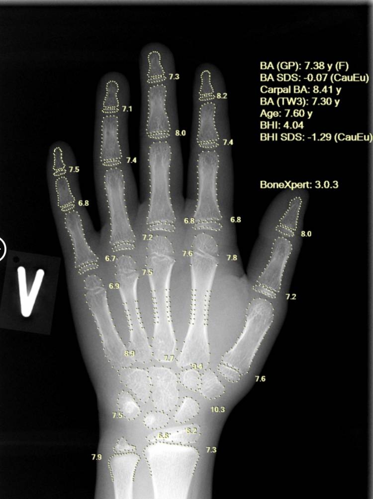 Aarthi Scans & Labs Rolls Out AI-Based Bone Age Technology across 100 Centres in India